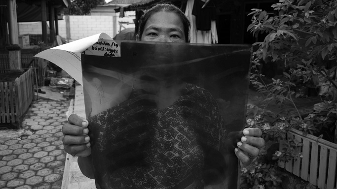 Ramini menunjukan foto X-ray flek pada paru-paru anaknya di Kampung Pulo Manuk, Indramayu, 23 Desember 2024. Asap batu bara dan limbah cair PLTU Indramayu 1 mencemari udara, tanah, dan perairan. (Foto: Prima Mulia/BandungBergerak)